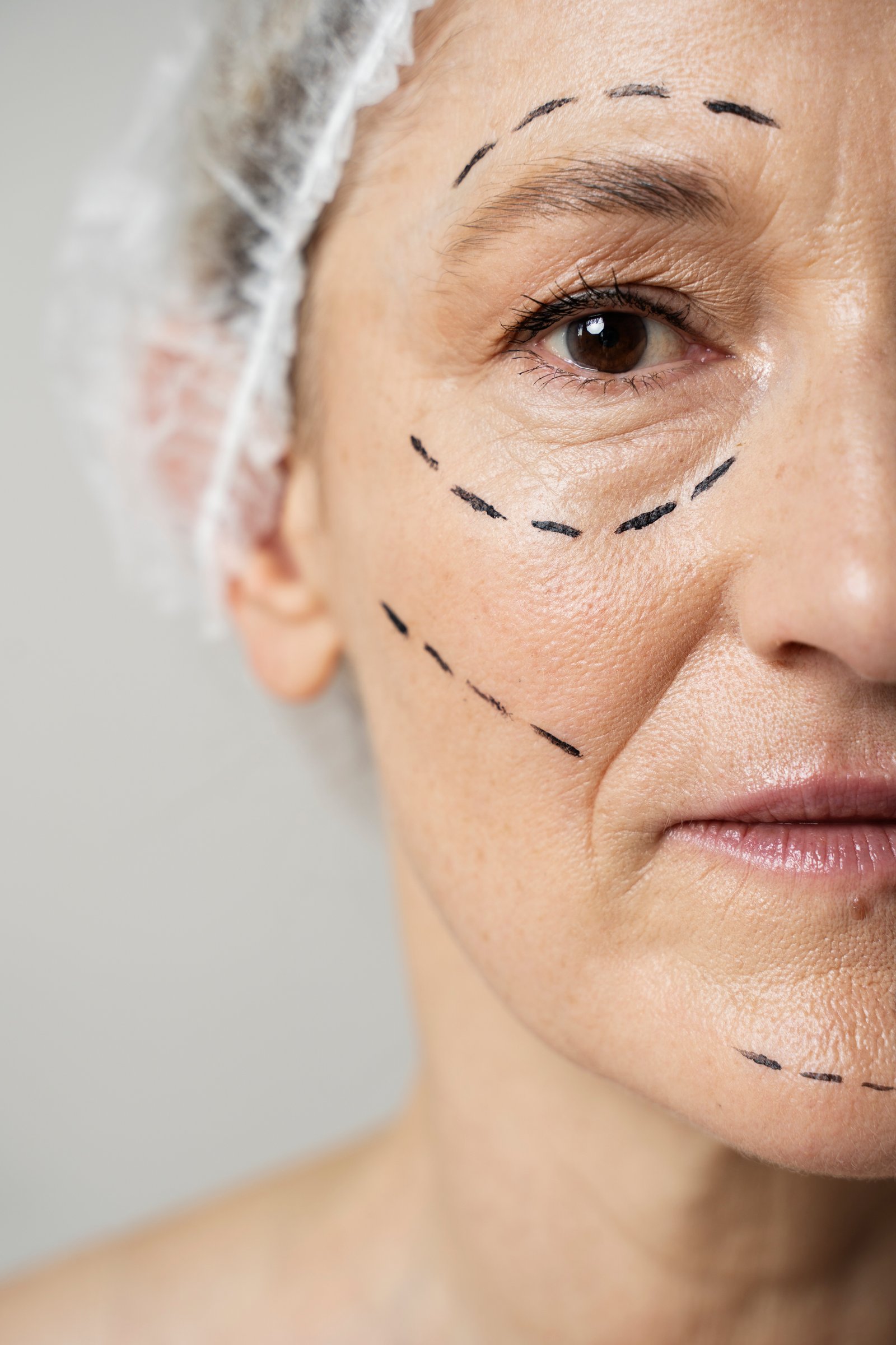 Face Procedures